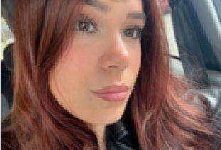 MESO FILLER - Siero all'Acido Ialuronico Puro